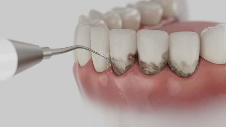 Trusted Wisdom Tooth Removal service in Lemoore, CA - Dentist Open Now